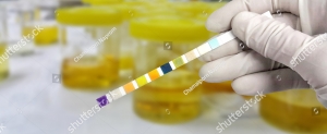 urinalisis